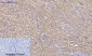 PI 3-kinase p110α Polyclonal Antibody